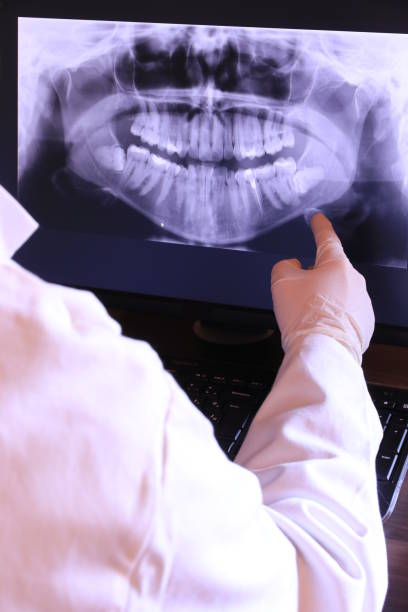 Best Emergency Dentist for Lost Fillings or Crowns in Marionville, MO
