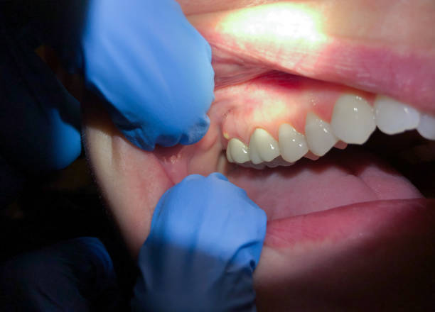 Best Pediatric Emergency Dentist in Marionville, MO