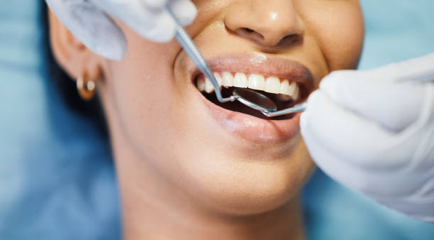 Best Emergency Dental Services for Seniors in Marionville, MO